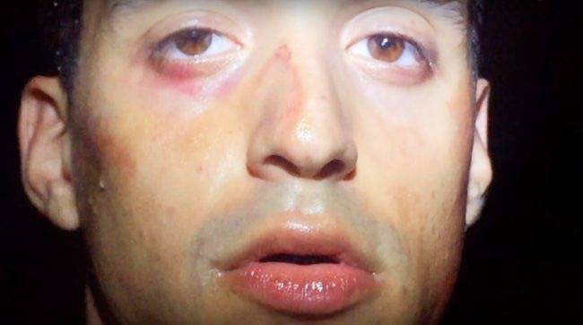 Arca-2016